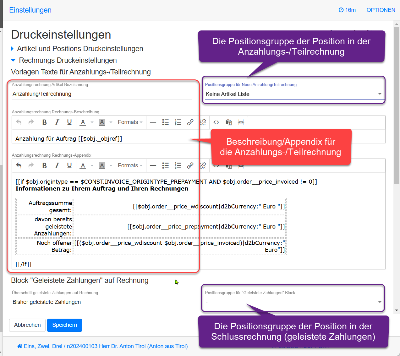 Einstellungen für die Anzahlungs-/Teilrechnung Einstellungen für die Anzahlungs-/Teilrechnung